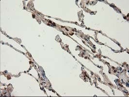 CAT / Catalase Antibody (clone 1B6, Carrier-free)