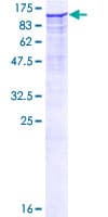 Human Dipeptidylpeptidase 8 / DPP8 Protein (Recombinant GST)