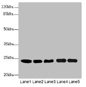 IHC-plus™ RAB5B Antibody