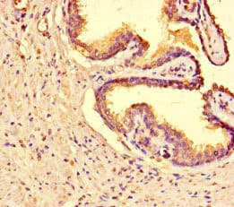 TANK2 / TNKS2 Antibody