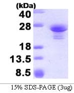 Human ASF1A Protein (Recombinant His)