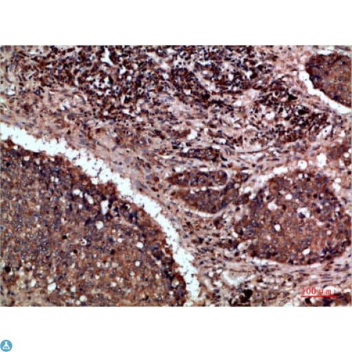 NAPSA / NAPA / Napsin A Antibody