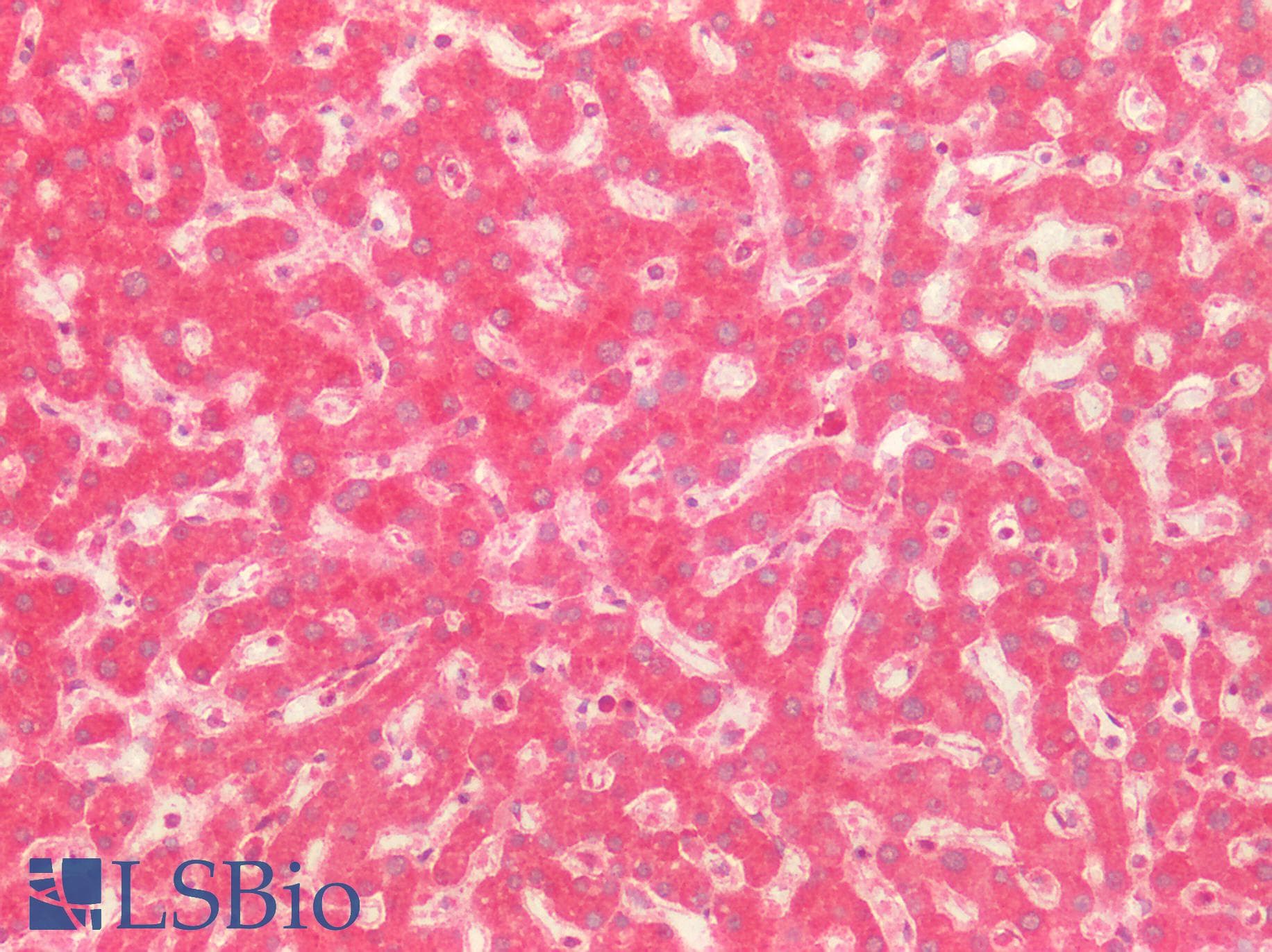 Polyclonal Rabbit anti-Mouse CD302 Antibody (aa21-225, IHC, WB)