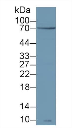 ZAP70 Antibody (aa337-600)