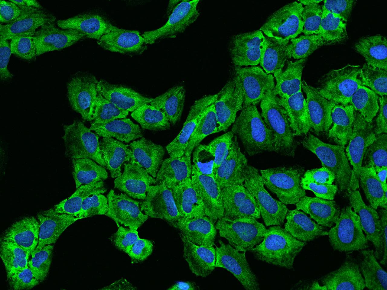 Polyclonal Rabbit anti-Human EIF4G1 / EIF4G Antibody (IHC, IF)