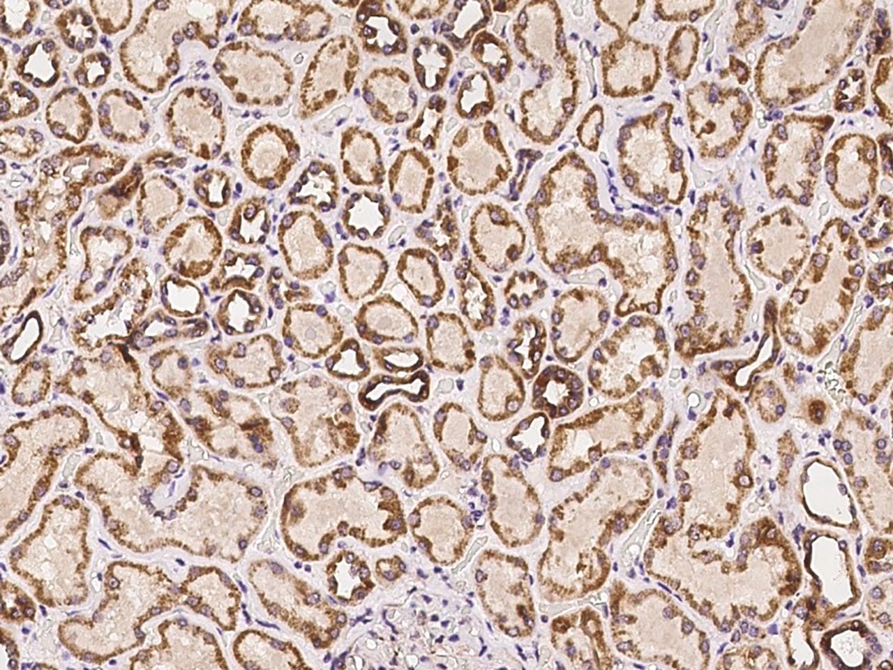 Polyclonal Rabbit anti-Human SCO1 Antibody (IHC)