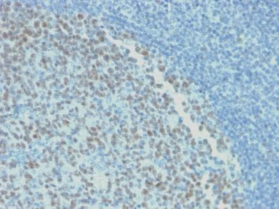 BCL6 Antibody (aa256-389, clone rBCL6/1718)