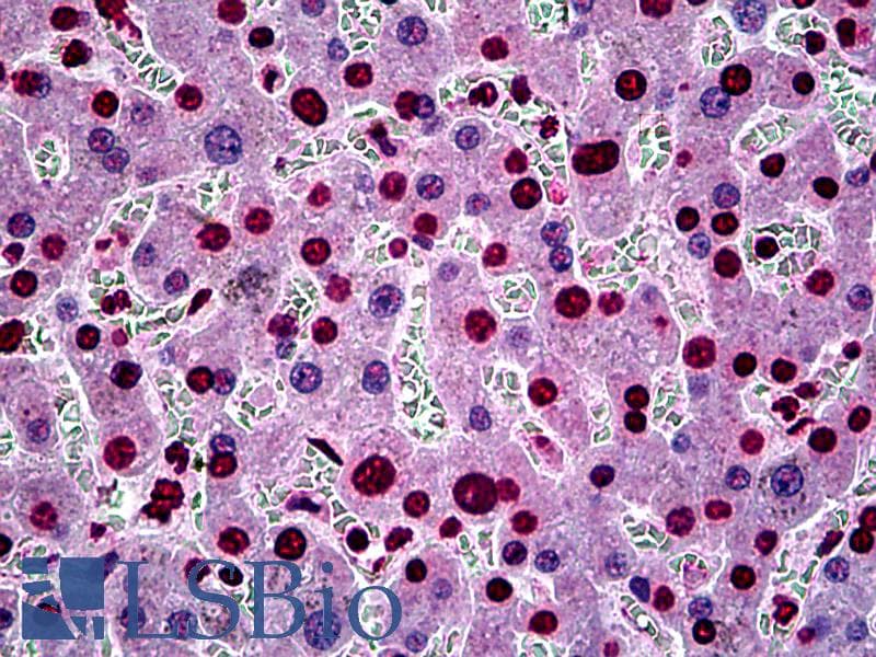 IHC-plus™ SGK1 / SGK Antibody (clone 3G8)