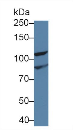 INVS / Inversin Antibody (aa1-237, APC)
