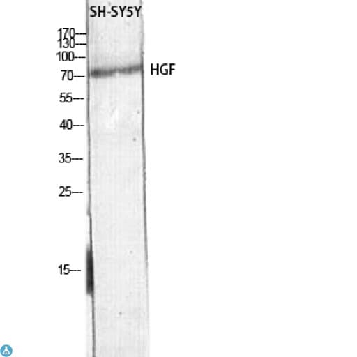 HGF / Hepatocyte Growth Factor Antibody