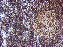 CYP17 / CYP17A1 Antibody (clone OTI3F11)