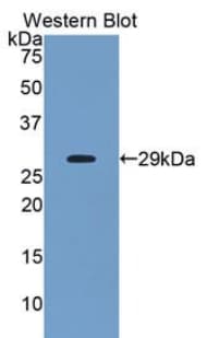 ANGPTL2 / ARP2 Antibody (aa267-493, Biotin)