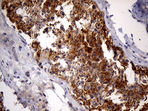 PYGM Antibody (aa698-842, clone OTI3F9)