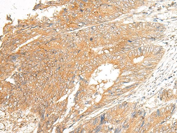 C5AR2 / GPR77 / C5L2 Antibody