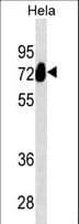Monoclonal Mouse anti-Human PLAP / Alkaline Phosphatase Antibody (aa56-83, WB)