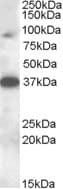 IHC-plus™ MARCH10 Antibody (aa778-788)