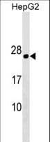 PLLP / Plasmolipin Antibody (aa1-30)
