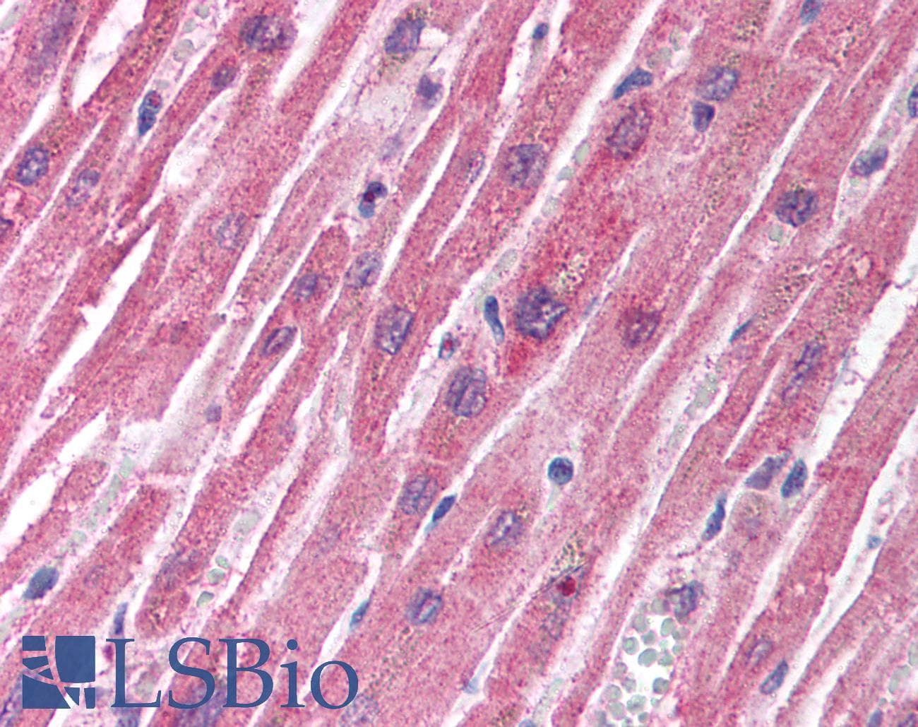 IHC-plus™ Hamartin / TSC1 Antibody