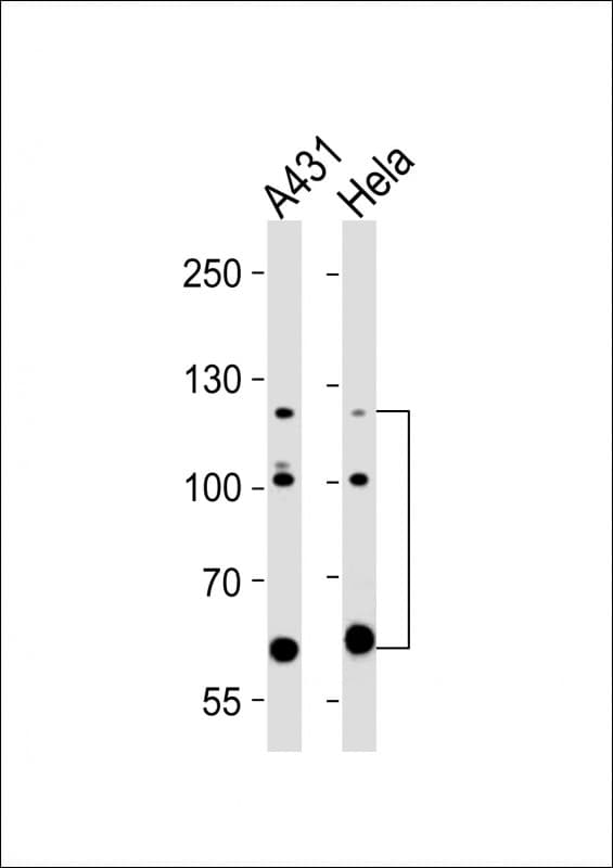Monoclonal Mouse anti-Human ABL2 Antibody (clone 1442CT175.30.33, WB)