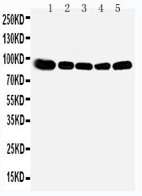 Polyclonal Rabbit anti-Human OSBP Antibody (aa290-304, WB)