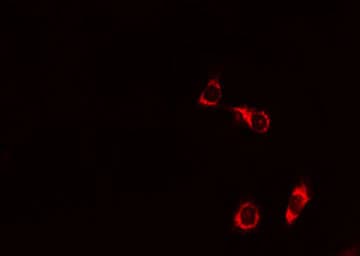Polyclonal Rabbit anti-Human BAD Antibody (phospho-Ser155, IHC, IF, WB)