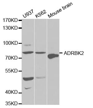 Polyclonal Rabbit anti-Human ADRBK2 / GRK3 Antibody (IHC, WB)