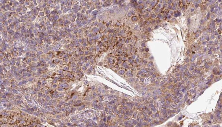 VISA / MAVS Antibody