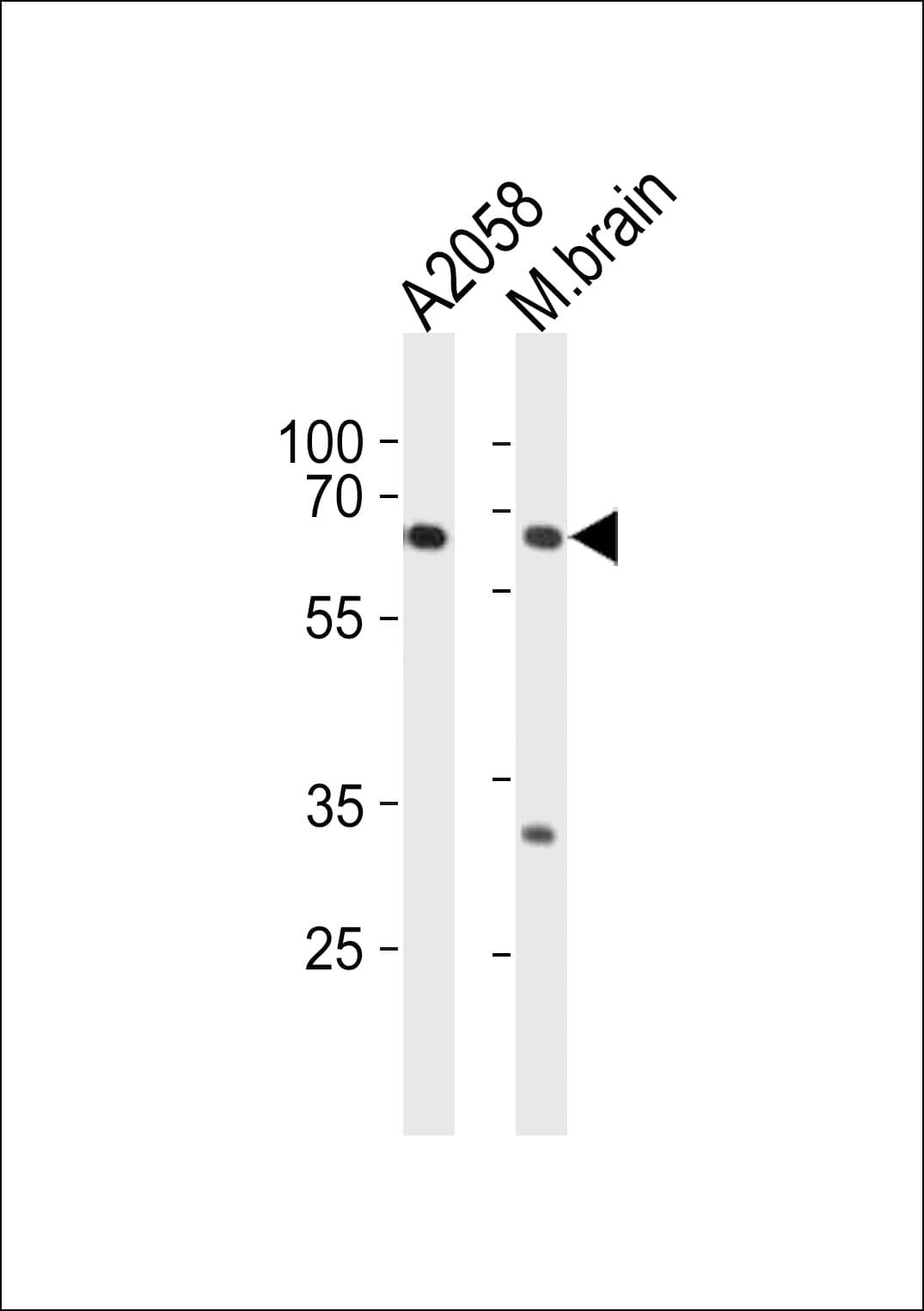 Polyclonal Rabbit anti-Human LZTS1 Antibody (aa77-105, WB)