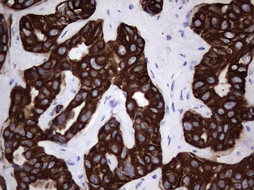 IHC-plus™ Acidic Cytokeratin Antibody (clone 1D10)