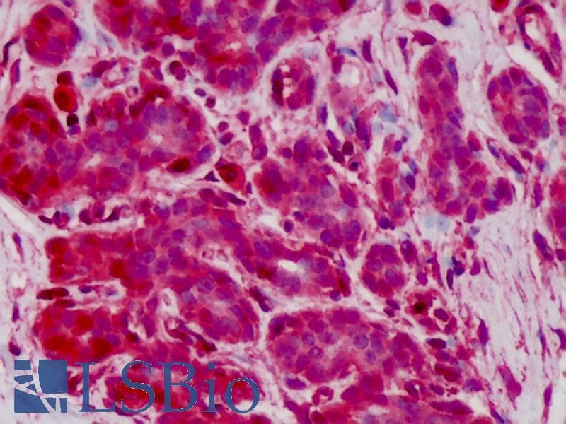 IHC-plus™ GPX1 / Glutathione Peroxidase Antibody