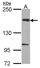 EVC2 Antibody (aa1246-1308)