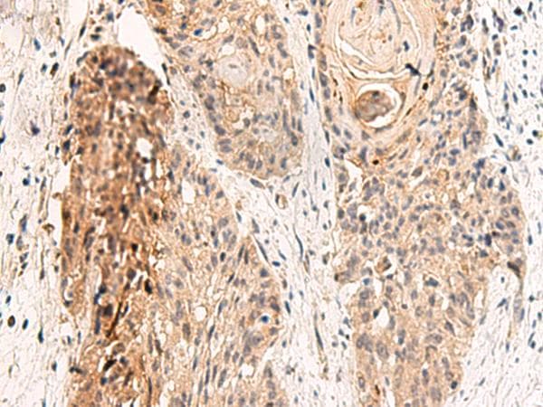 Polyclonal Rabbit anti-Human GPR152 Antibody (IHC)