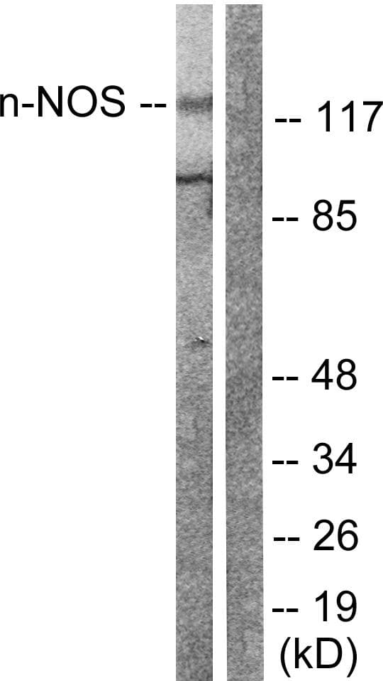 Polyclonal Rabbit anti-Human NOS1 / nNOS Antibody (p852, IF, WB)