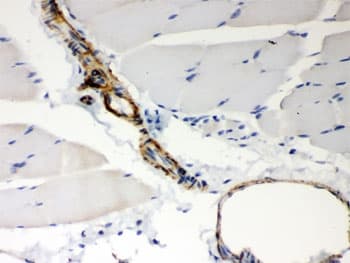 BAK1 / BAK Antibody