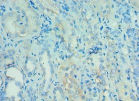 ANGPTL4 Antibody (aa26-406)