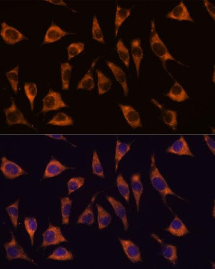 GPR22 Antibody
