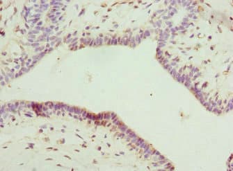 IL-22BP / IL22RA2 Antibody