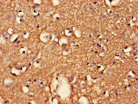 CDK5RAP2 Antibody