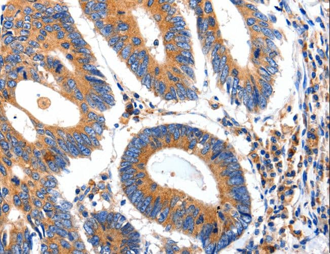 Polyclonal Rabbit anti-Human IGFBP7 / TAF Antibody (IHC)