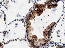 AK5 / Adenylate Kinase 5 Antibody (clone OTI2F9)