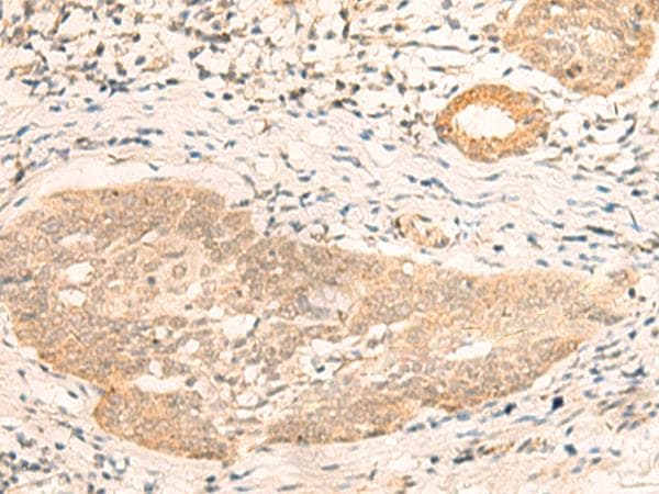 Polyclonal Rabbit anti-Human CALCOCO1 / CoCoa Antibody (IHC)