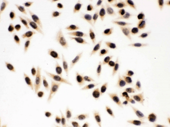 Polyclonal Rabbit anti-Human NBN / Nibrin Antibody (IHC, WB)