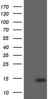 CDKN2B / p15 INK4b Antibody (clone OTI3B6)