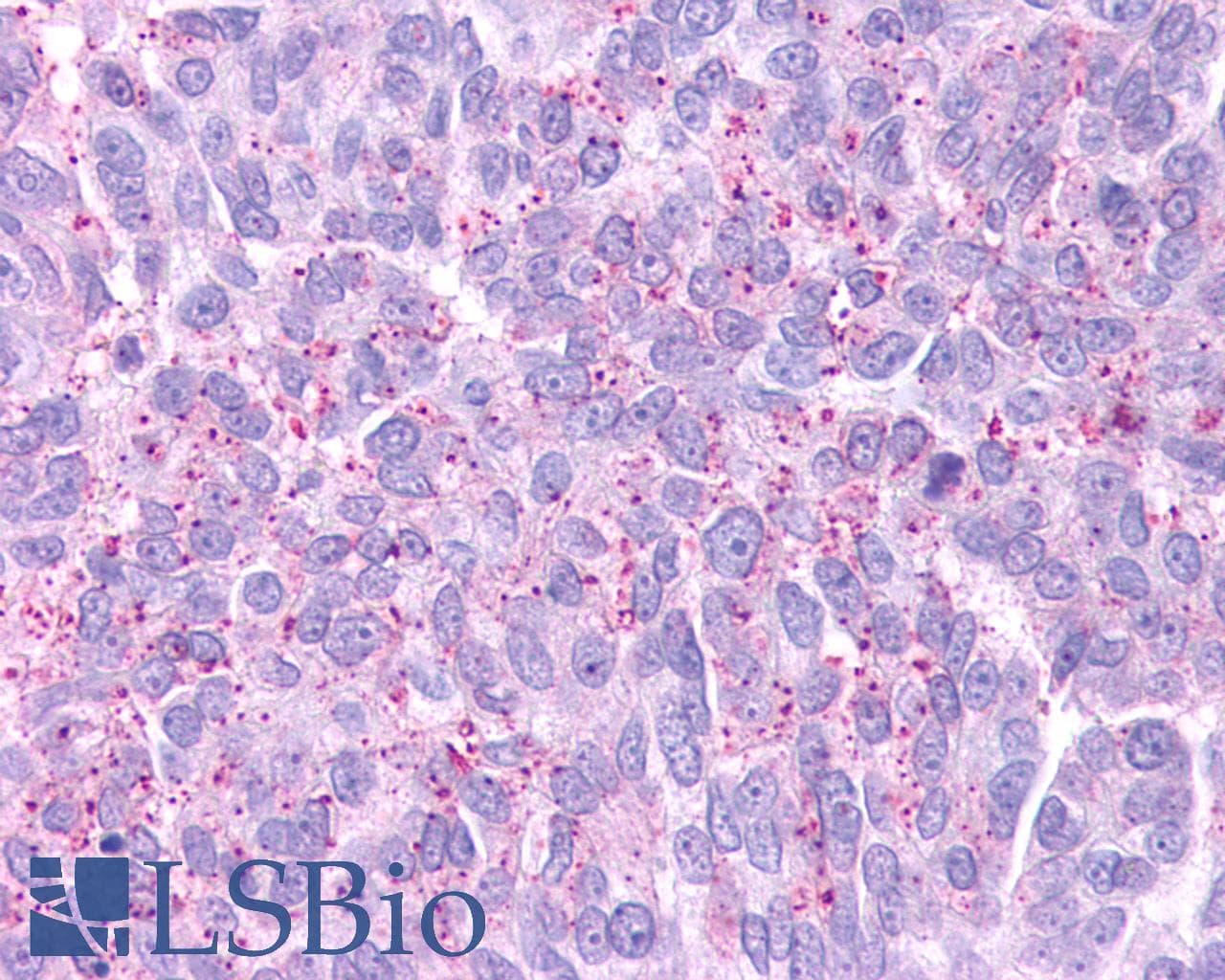 IHC-plus™ Polyclonal Rabbit anti-Human GPR88 Antibody (C-Terminus, IHC)