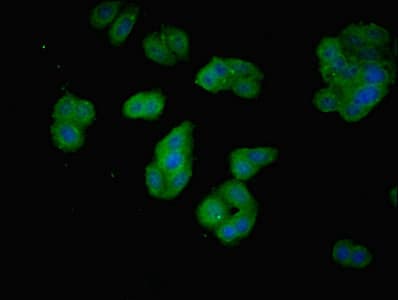 Polyclonal Rabbit anti-Human PDCL2 Antibody (IHC, WB)