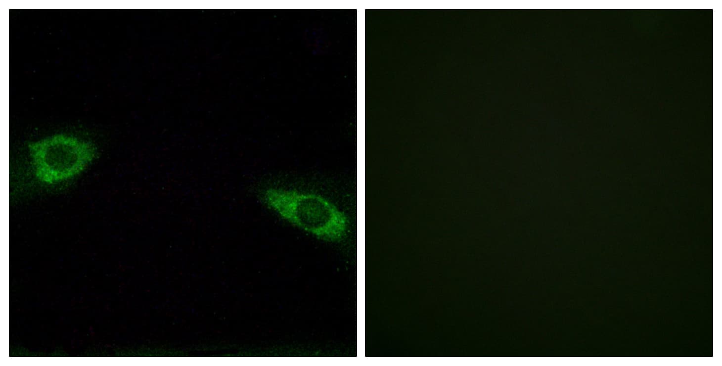 IHC-plus™ RPS4X + RPS4Y1 + RPS Antibody (aa214-263)