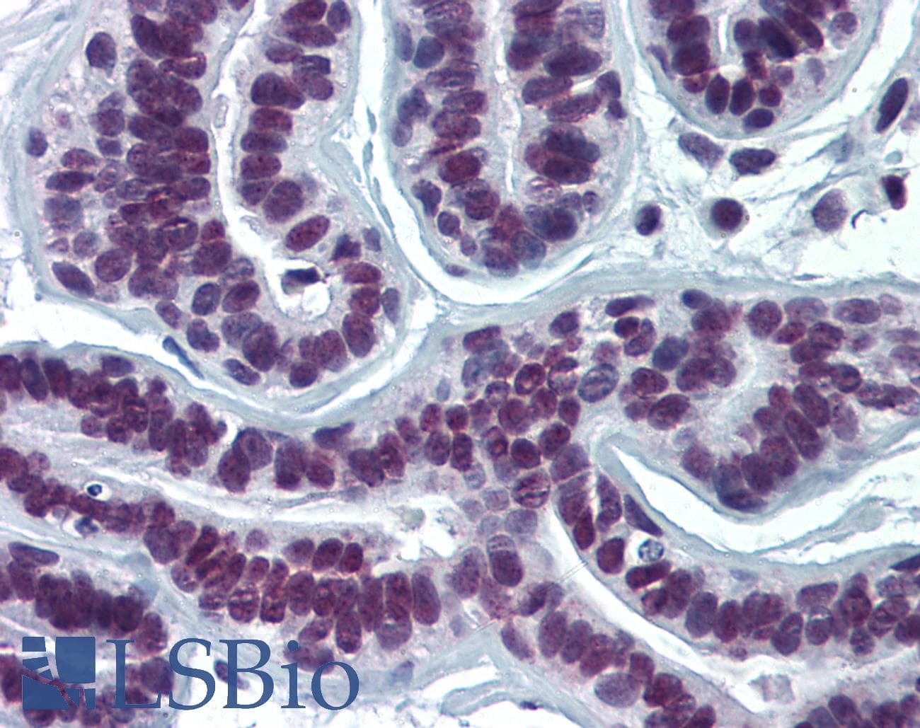 IHC-plus™ SUMO2 + SUMO3 Antibody (clone 2H8)