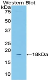 SLC12A3 / TSC Antibody (aa3-146)