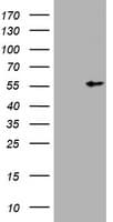 Monoclonal Mouse anti-Human Vimentin Antibody (clone OTI3G4, aa210-466, WB)