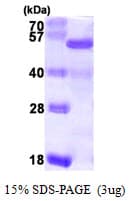 Human NELFE / RD / RDBP Protein (Recombinant His)